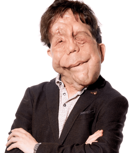Adam Pearson Official Speaker Profile Picture
